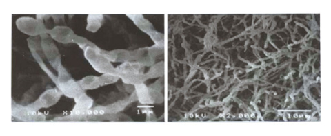 Fig.3-33 Typical tritium oxidizing bacteria (by SEM) 