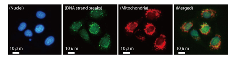 Fig.4-15 DNA strand breaks in mitochondria of mammalian cells following γ ray irradiation