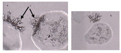 Photo 6-1 Transmission electron microscopy photographs of yeast cells exposed to a uranium solution (a, b) 
