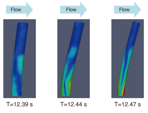 Fig.11-10　Time variations in cylinder deformation