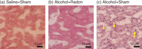 Fig.13-25　Radon inhalation inhibits alcohol-induced oxidative injury in mouse liver