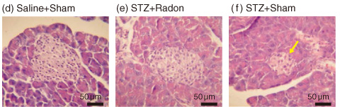 Fig.13-26　Radon inhalation inhibits Streptozocin (STZ)-induced diabetes in mouse pancreas