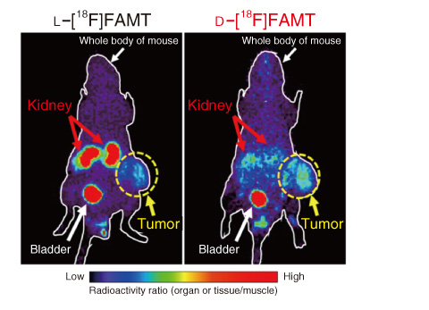 Fig.5-8　Comparison of images with L-[18F]FAMT and D-[18F]FAMT