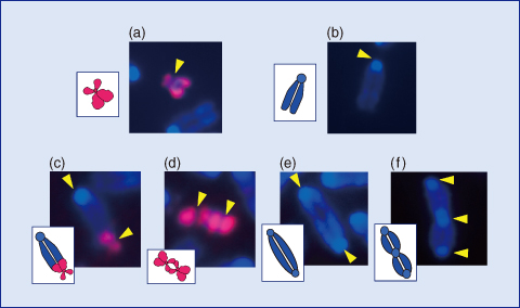 Fig.3-11　Typical chromosome aberrations microscopically observed