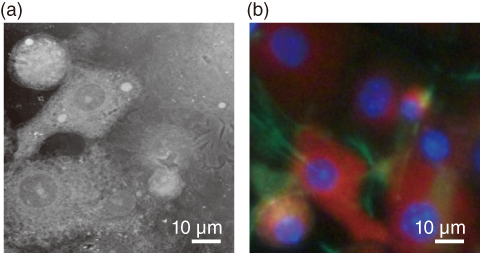 Fig.5-24　(a) Soft X-ray image and (b) fluorescent image of living cells 