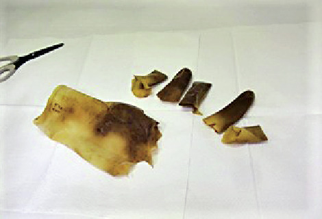 Fig.8-7  Sample of combustible wastes