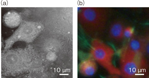 図5-24　生きている細胞の（a）軟X線像と（b）蛍光像