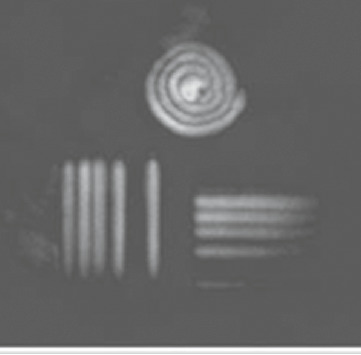 図7-11　水中において超音波により取得した画像