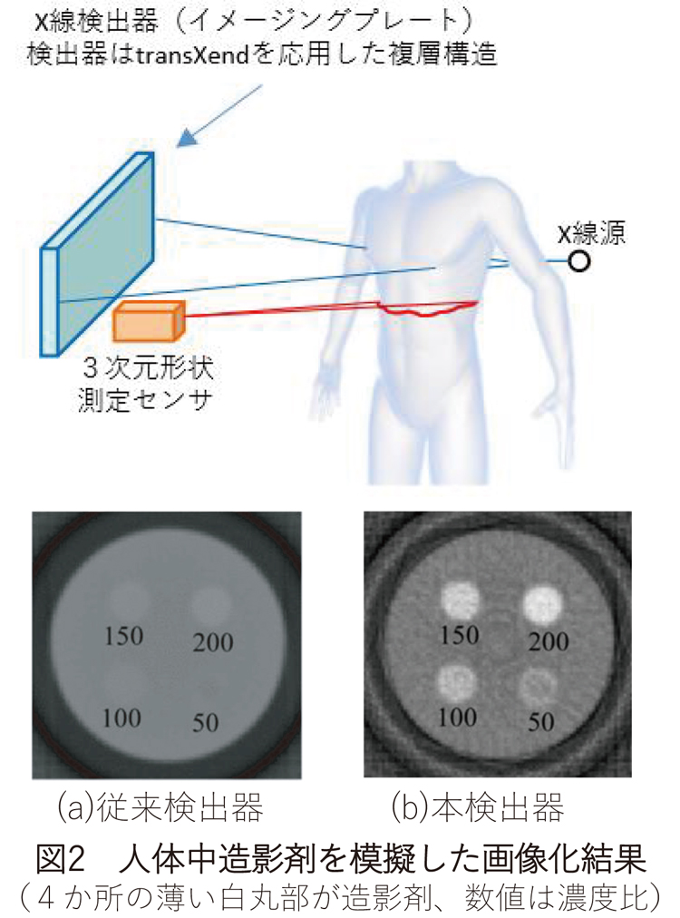 小型複層構造の放射線検出器によるX線撮影で高速簡便に人体を可視化 | 技術シーズ集第７版